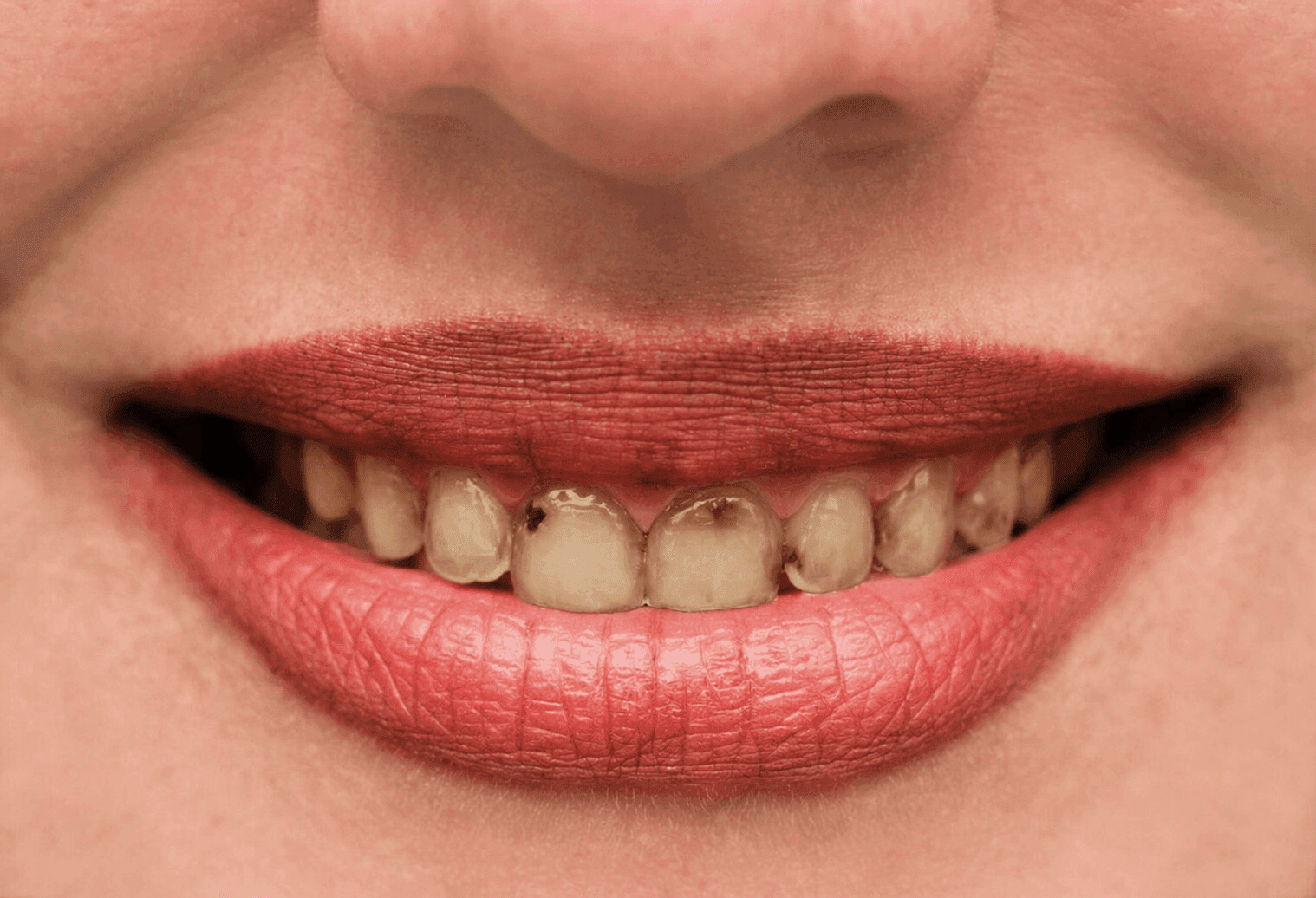 Before dental treatment comparison image